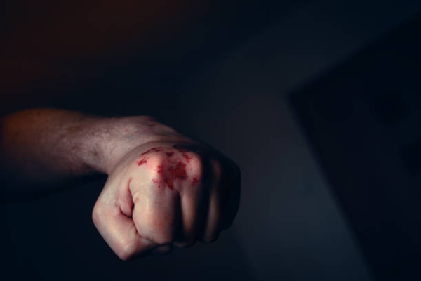 Доглядав за пенсіонером, а потім вбив: На Черкащині чоловіка підозрюють у побитті до смерті